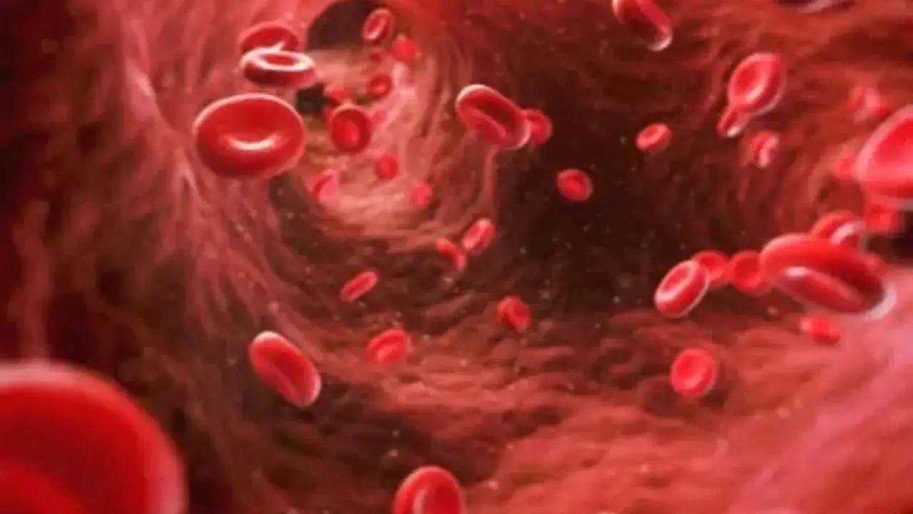 Hipertensão emergindo como uma das principais causas de acidente vascular cerebral na Índia: especialistas