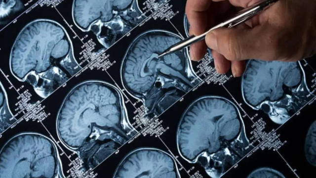 brain-1781521024801_d.png